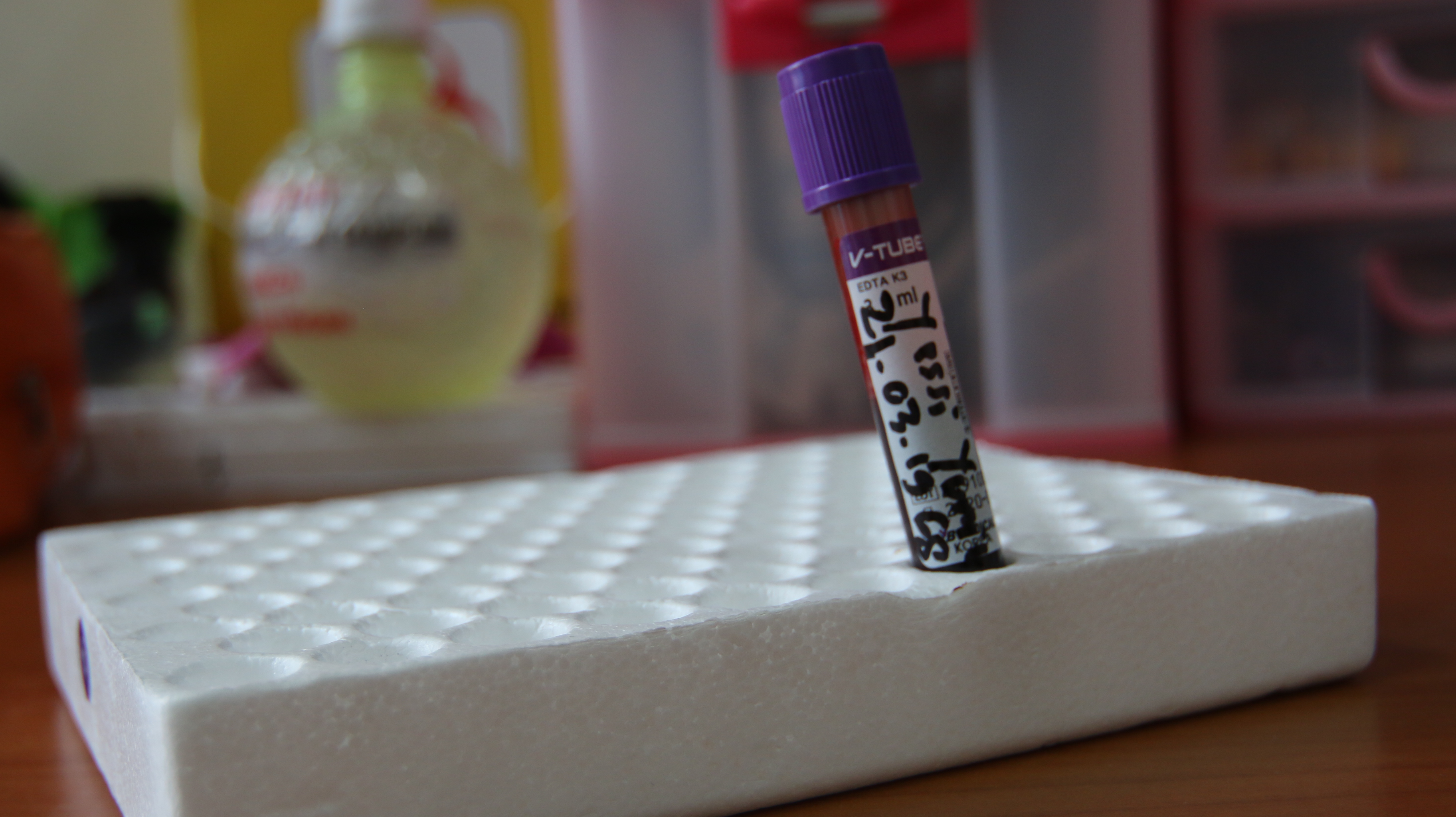 Bawaslu Kepri Jalani Rapid Test Kedua