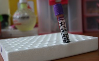 Bawaslu Kepri Jalani Rapid Test Kedua